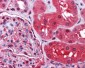 RDX / Radixin Antibody (Internal)